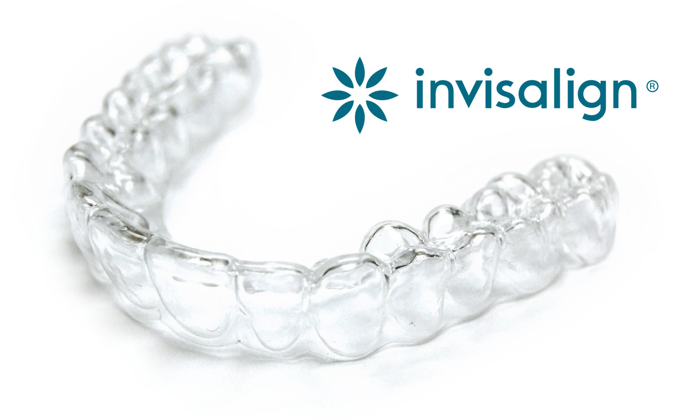 Ortodoncia Málaga Invisalign