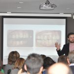 Master de Invisalign Ortodoncia Málaga