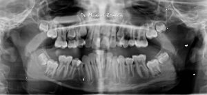 Ortodoncia Málaga Radiografía