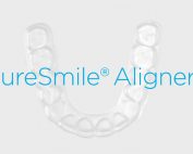 SureSmile - Preguntas y respuestas