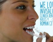 We love Invisalign en Malaga