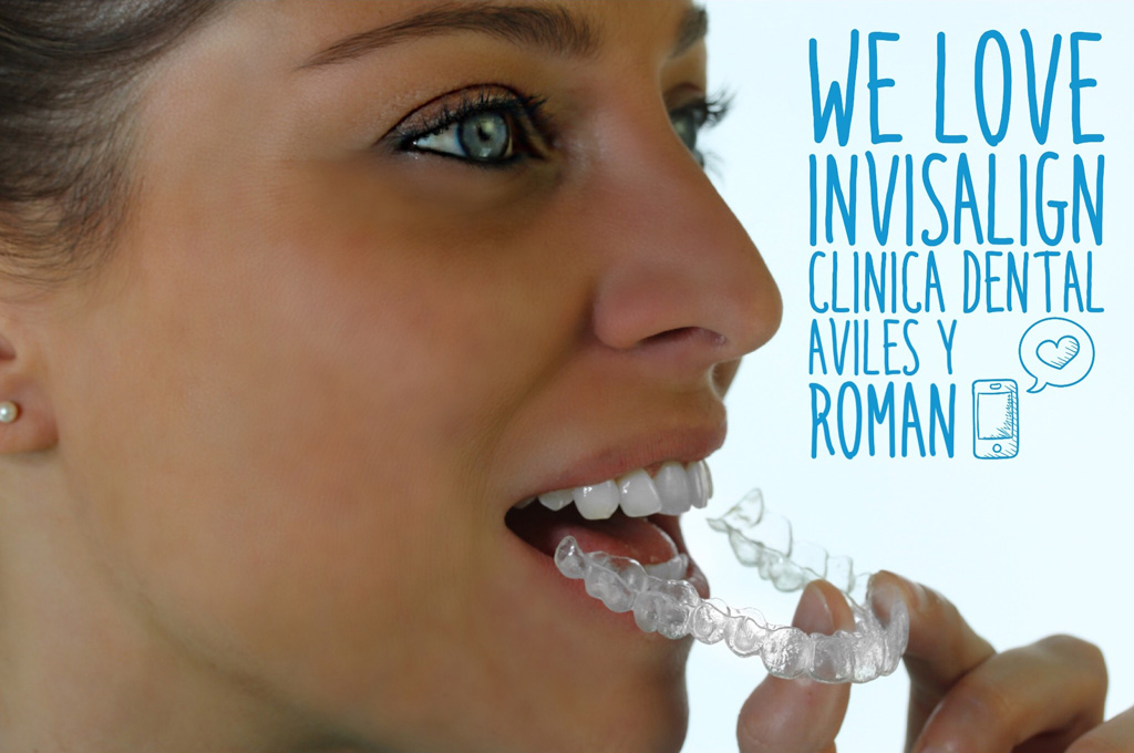 We love Invisalign en Malaga