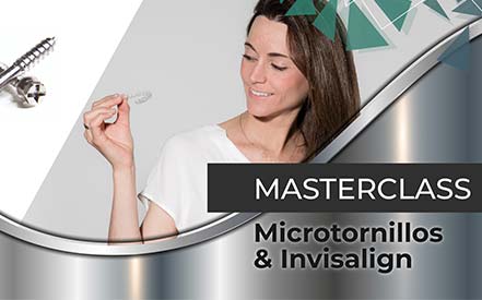 Masterclass Microtornillos & Invisalign