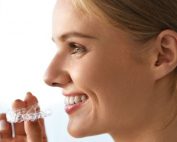 Cuidados a tener en cuenta con Invisalign