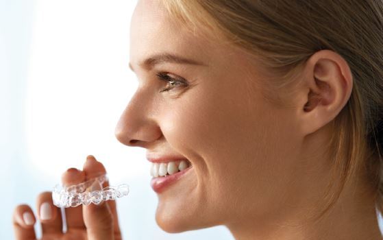 Cuidados a tener en cuenta con Invisalign