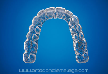 Invisalign