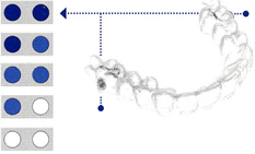 Indicadores colaboracion Invisalign Teen