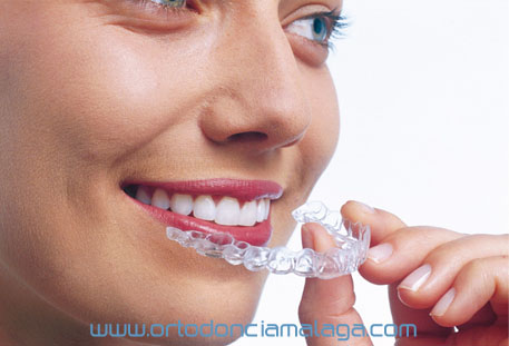 Invisalign