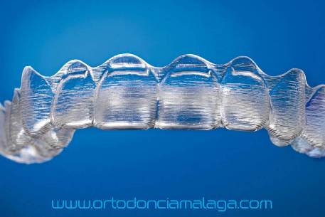 invisalign power ridges Málaga