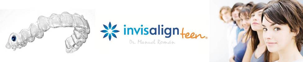 Invisalign Teen