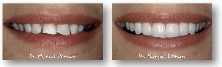 Estética dental y Ortodoncia Málaga