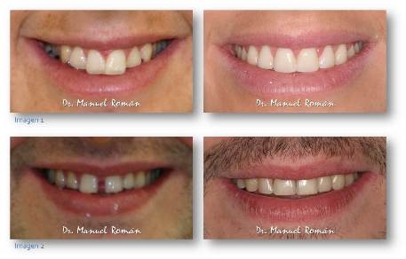 Estética dental y Ortodoncia Málaga