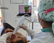 escaner intraoral